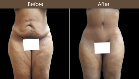 20202705151523_B9-Front